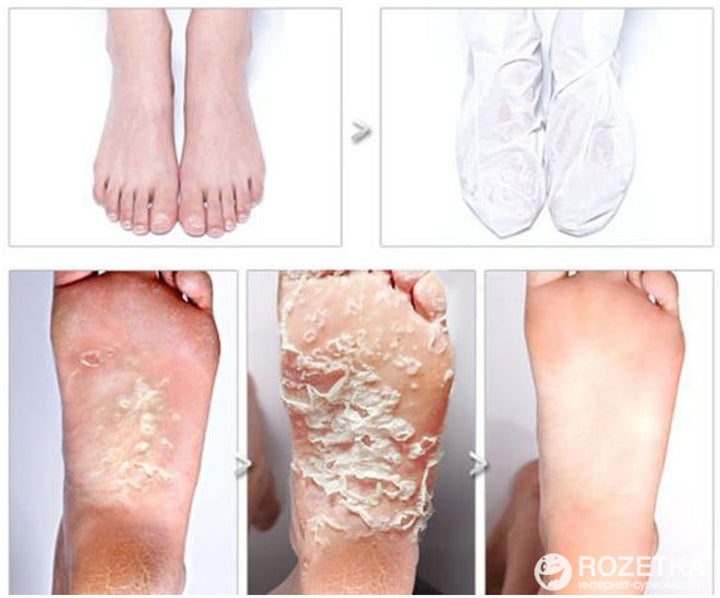 Foot Peeling Pack 1pcs