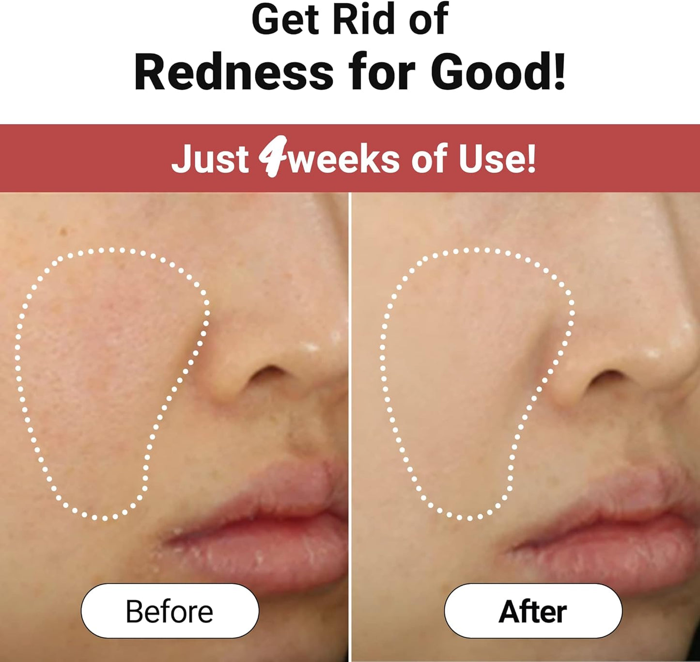 Clear Redmark Soothing Facial Sheet Mask 1pc