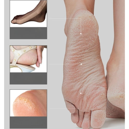 Foot Peeling Mask- Kiwi 2pc