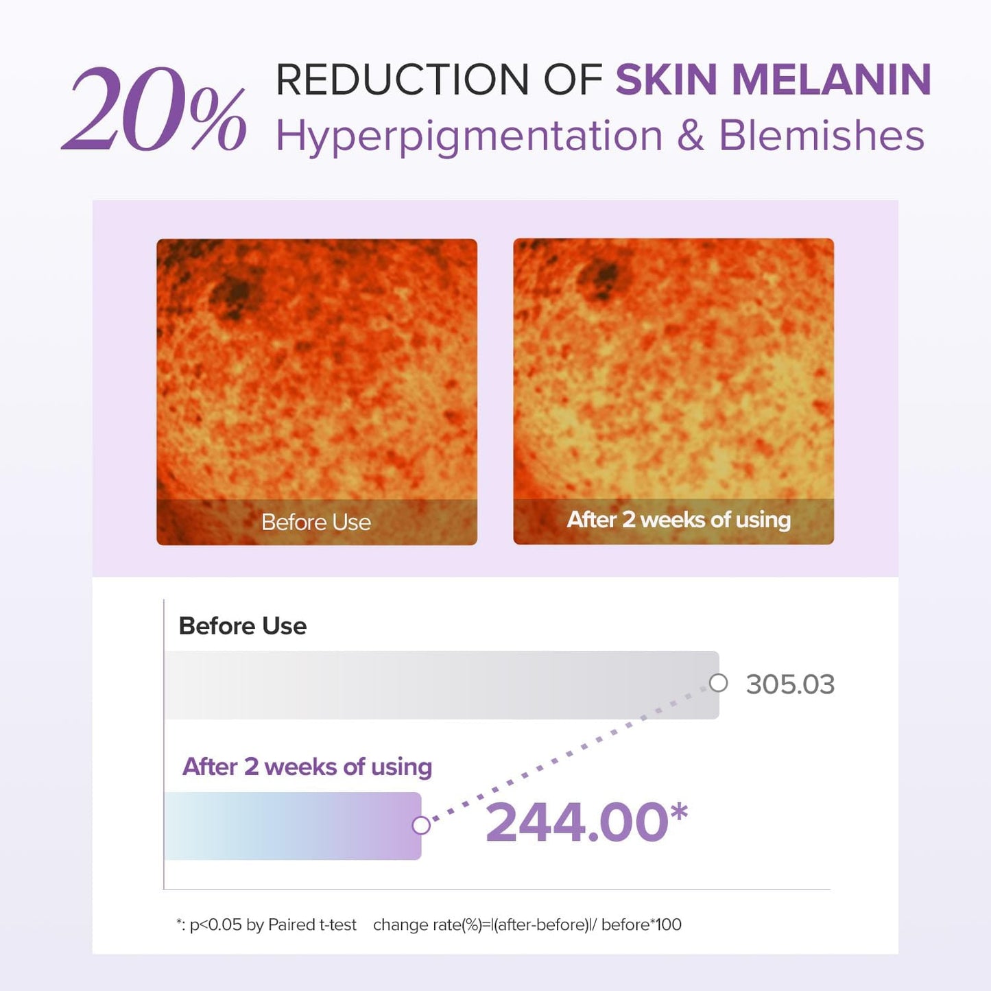 Glutathione Eye Cream Special Set 30g+12g*2