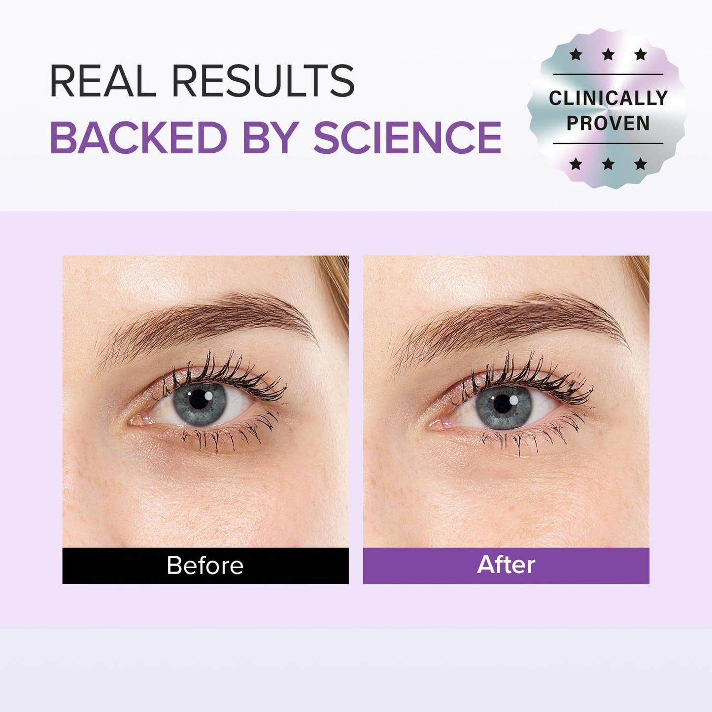 Tranexamic Acid+Glutathione Eye Cream 12g