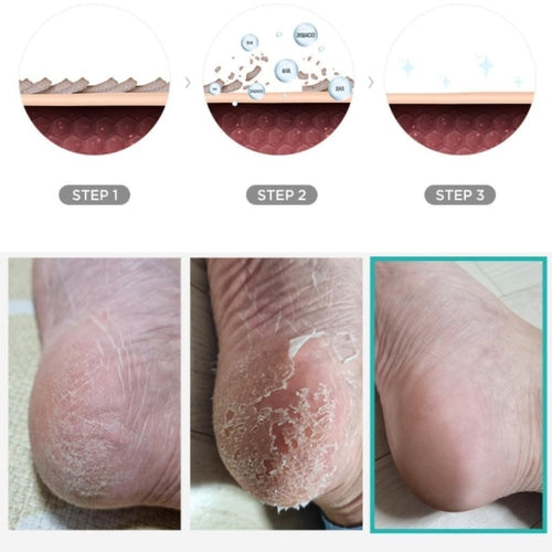 Foot Peeling Mask- Aloe & Watermelon 2pc